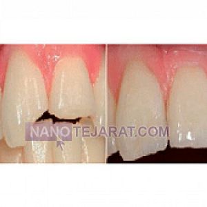 ماده ترمیمی و زیبایی bisico ماده ترمیمی و زیبایی bisico